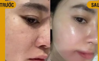 Serum Dưỡng Da Mirai Lab Pure Retinol Hight Class Moist Essence
