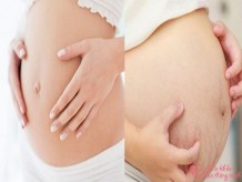 Có thai bụng cứng hay mềm là tốt để thai nhi phát triển bình thường?