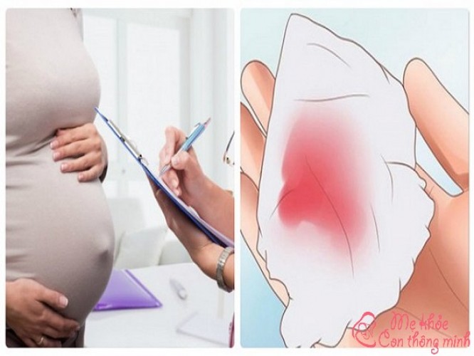 Ra máu cục khi mang thai tháng đầu có nguy hiểm không?