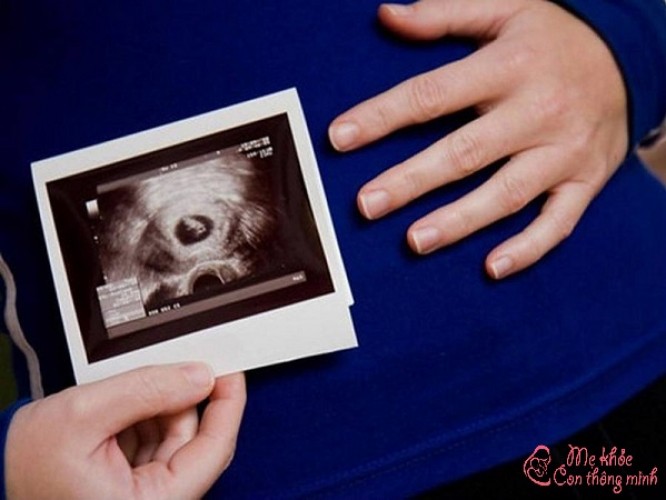 Túi thai là gì? Túi thai bao nhiêu mm thì có tim thai?