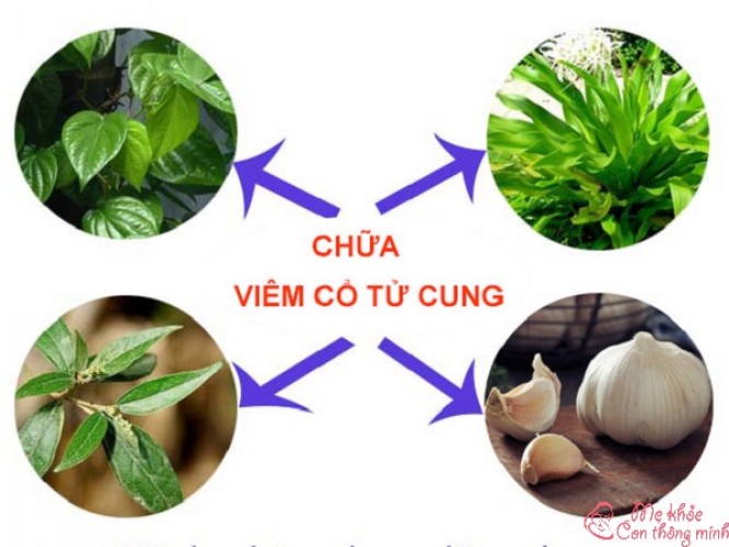 7 cách chữa viêm cổ tử cung tại nhà vừa nhanh vừa dễ