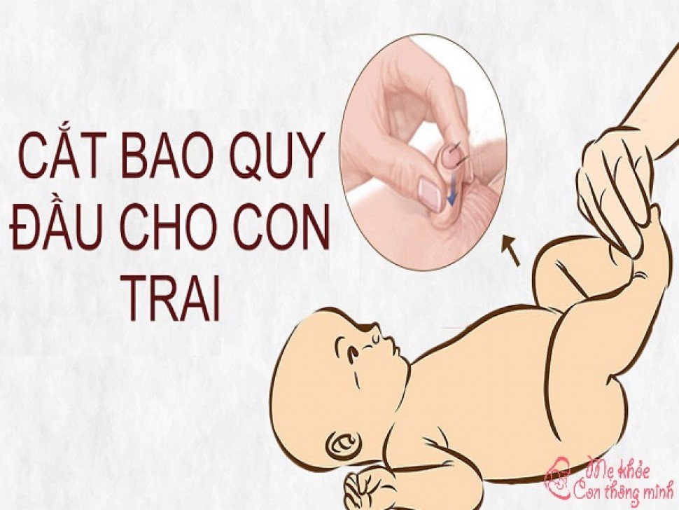 Những kinh nghiệm cần biết khi cắt bao quy đầu cho bé