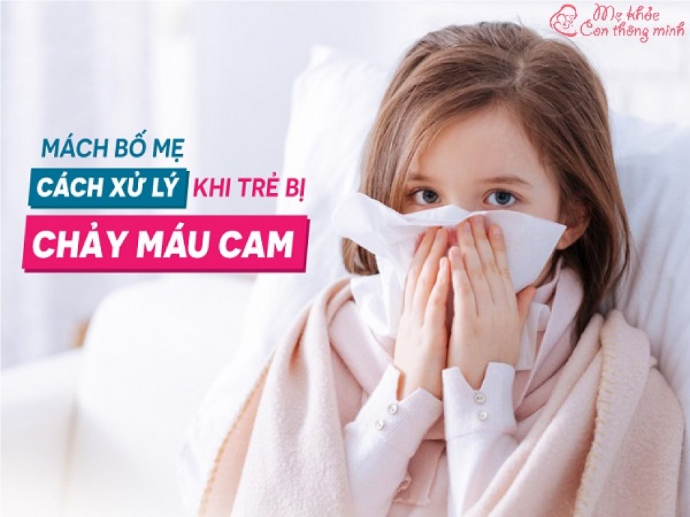 Chảy máu cam là gì? Cách xử lý trẻ khi bị chảy máu cam