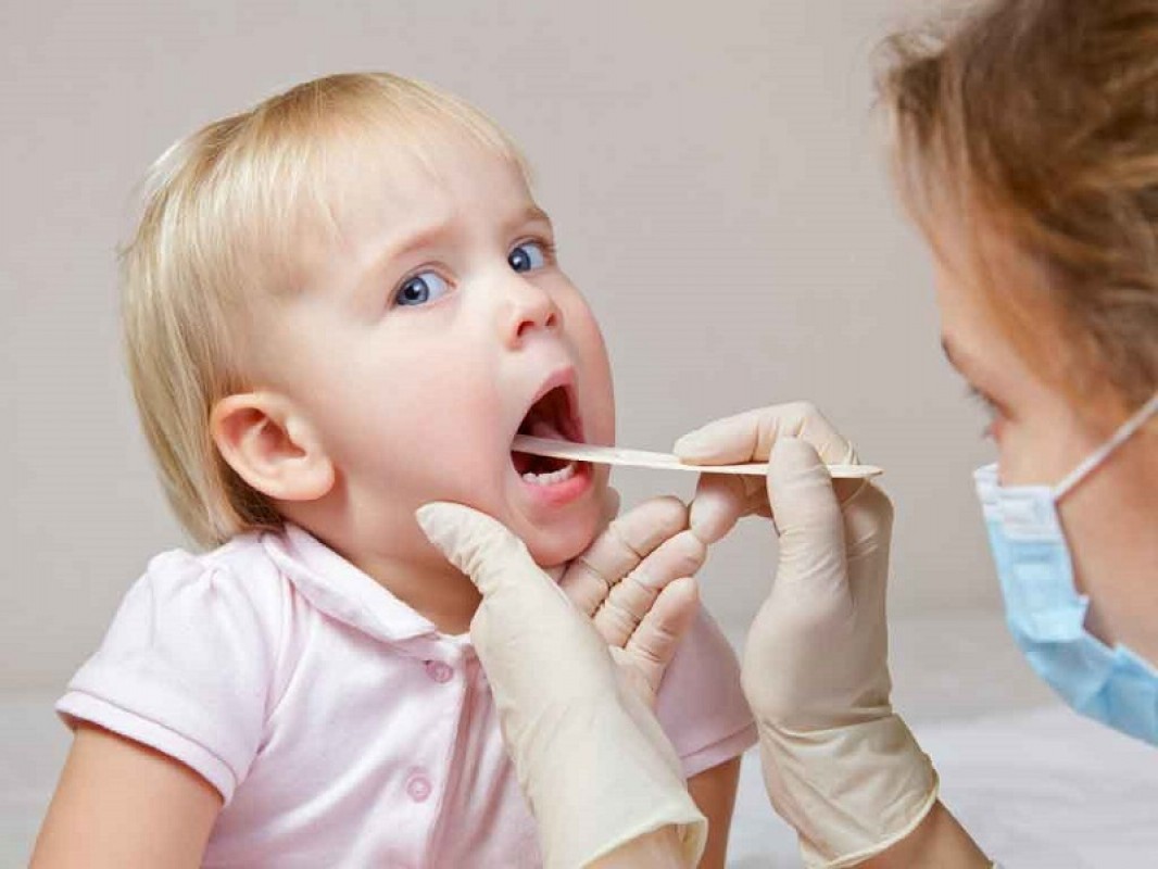 Trẻ Em Bị Hôi Miệng Là Bệnh Gì? Nguyên Nhân Và Cách Chữa